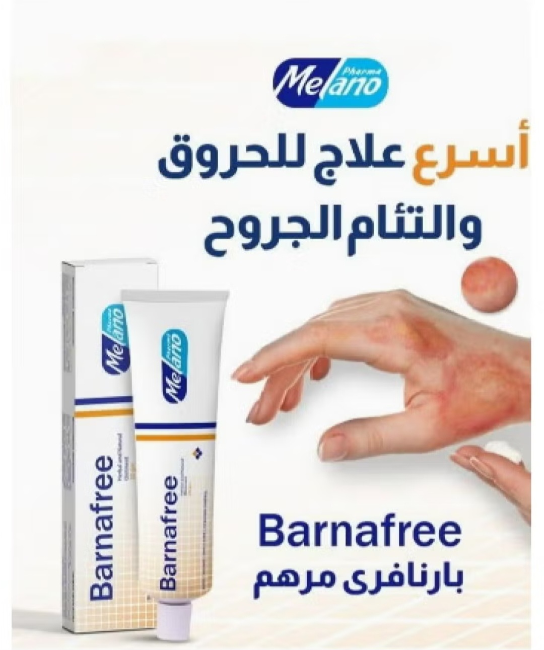 بارنافري مرهم من ميلانو للحروق - Image 3